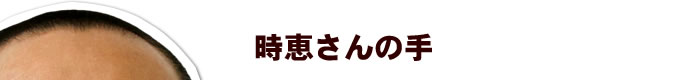 時恵さんの手